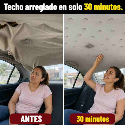 Kit de Clips para Reparación de Techo de Carro (60 piezas) - Pago Contra Entrega